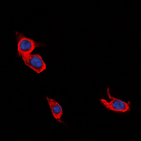 3 - Anti-L1CAM Antibody AP60678