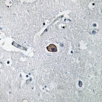 19 - Anti-L1CAM Antibody AP60678