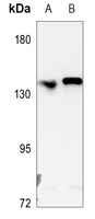 1 - Anti-L1CAM Antibody AP60678