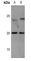 1 - Anti-CD306 Antibody AP60679