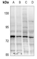 1 - Anti-TAK1 (Phospho-T187) Antibody AP60682