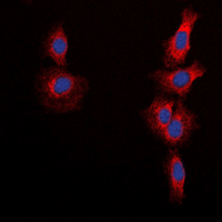 3 - Anti-mTOR (Phospho-S2448) Antibody AP60683