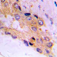 19 - Anti-mTOR (Phospho-S2448) Antibody AP60683