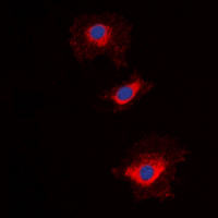 3 - Anti-NT5C1A Antibody AP60684