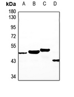 1 - Anti-NT5C1A Antibody AP60684