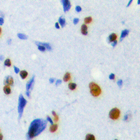 19 - Anti-POLR3H Antibody AP60685