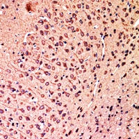 19 - Anti-HSN1 Antibody AP60688