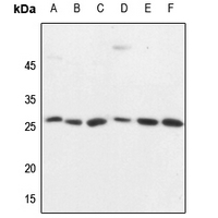 1 - Anti-CD137 Antibody AP60689