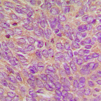 19 - Anti-GCP6 Antibody AP60691