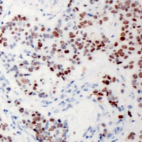 19 - Anti-XRN2 Antibody AP60693