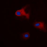 3 - Anti-14-3-3 theta/tau (Phospho-S232) Antibody AP60694