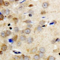 19 - Anti-14-3-3 theta/tau (Phospho-S232) Antibody AP60694