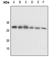 1 - Anti-14-3-3 theta/tau (Phospho-S232) Antibody AP60694