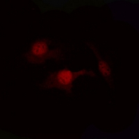 3 - Anti-PTEN (Phospho-S380/T382/T383) Antibody AP60695