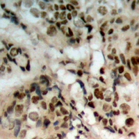 19 - Anti-PTEN (Phospho-S380/T382/T383) Antibody AP60695