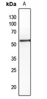 1 - Anti-PTEN (Phospho-S380/T382/T383) Antibody AP60695