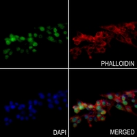 3 - Anti-Histone H2A.X (Phospho-S139) Antibody AP60698
