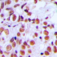 19 - Anti-Histone H2A.X (Phospho-S139) Antibody AP60698