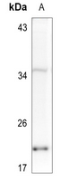 1 - Anti-Histone H2A.X (Phospho-S139) Antibody AP60698