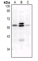 1 - Anti-c-FOS (Phospho-S32) Antibody AP60700