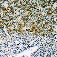 19 - Anti-p47 phox (Phospho-S345) Antibody AP60701
