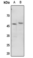 1 - Anti-p47 phox (Phospho-S345) Antibody AP60701
