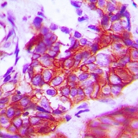 19 - Anti-TRK A Antibody AP60702