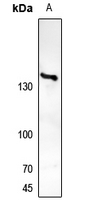 1 - Anti-TRK A Antibody AP60702