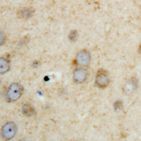 19 - Anti-SPHK2 Antibody AP60703