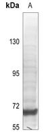 1 - Anti-SPHK2 Antibody AP60703