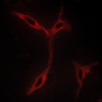 3 - Anti-CADM1 Antibody AP60704