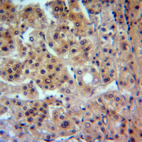 19 - Anti-CADM1 Antibody AP60704