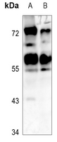 1 - Anti-CADM1 Antibody AP60704
