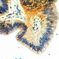 19 - Anti-Apolipoprotein O-Like Antibody AP60705
