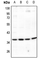 1 - Anti-EIF3J Antibody AP60706