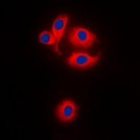 3 - Anti-MRPS22 Antibody AP60707