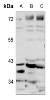 1 - Anti-MRPS22 Antibody AP60707