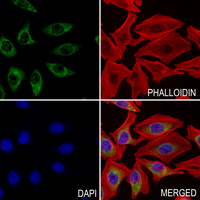 3 - Anti-MT-ND5 Antibody AP60708