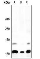 1 - Anti-Alpha Fodrin Antibody AP60711