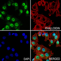 3 - Anti-B-RAF (Phospho-S446) Antibody AP60713