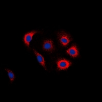 3 - Anti-EGFR (Phospho-Y1016) Antibody AP60714
