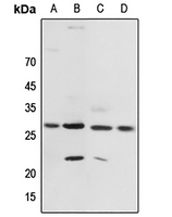 1 - Anti-14-3-3 zeta (Phospho-T232) Antibody AP60715