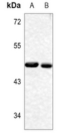1 - Anti-YBX1 (Phospho-S102) Antibody AP60716