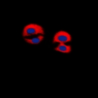 3 - Anti-Dematin Antibody AP60717