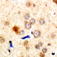 19 - Anti-Dematin Antibody AP60717