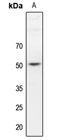 1 - Anti-Dematin Antibody AP60717