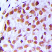 19 - Anti-TAF5L Antibody AP60719