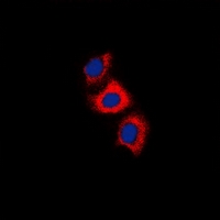 3 - Anti-Recoverin Antibody AP60720