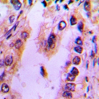 19 - Anti-Recoverin Antibody AP60720