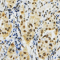 19 - Anti-ID4 Antibody AP60722